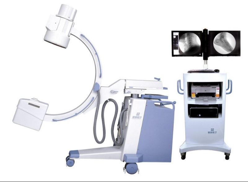 胆结石ERCP治疗C型臂机